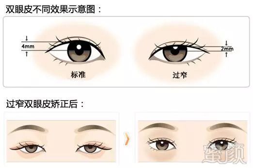 https://img.miyanlife.com/mnt/timg/180912/1139591118-5.jpg