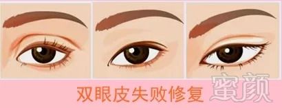 https://img.miyanlife.com/mnt/timg/180912/1139593396-6.jpg