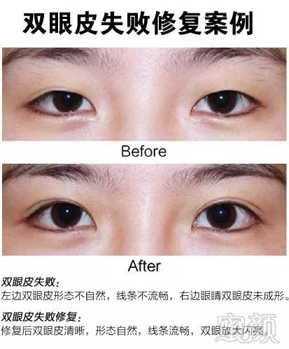 https://img.miyanlife.com/mnt/timg/180912/11395a5K-2.jpg