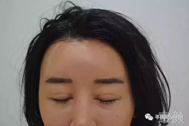 https://img.miyanlife.com/mnt/timg/180912/1144354M0-1.jpg