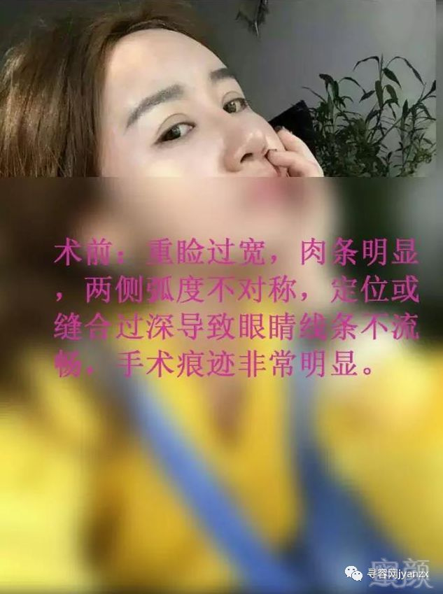 https://img.miyanlife.com/mnt/timg/180912/1144354N4-2.jpg