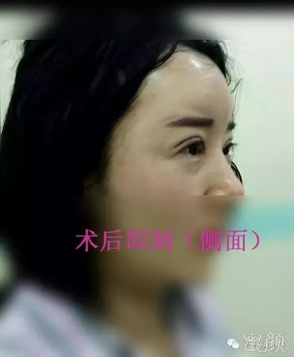 https://img.miyanlife.com/mnt/timg/180912/1144361113-7.jpg