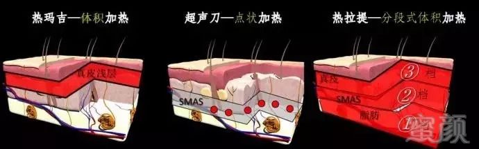 https://img.miyanlife.com/mnt/timg/180912/11460923A-8.jpg