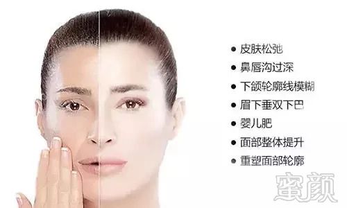 https://img.miyanlife.com/mnt/timg/180912/1146104393-10.jpg