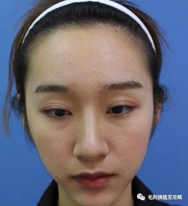https://img.miyanlife.com/mnt/timg/180912/120R94b3-3.jpg