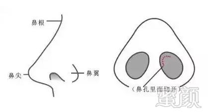 https://img.miyanlife.com/mnt/timg/180912/1214433F4-2.jpg