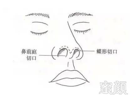 https://img.miyanlife.com/mnt/timg/180912/12144343c-3.jpg