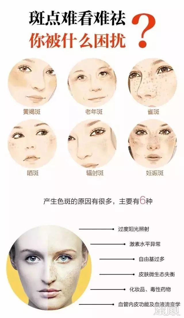 https://img.miyanlife.com/mnt/timg/180912/1251341W3-0.jpg
