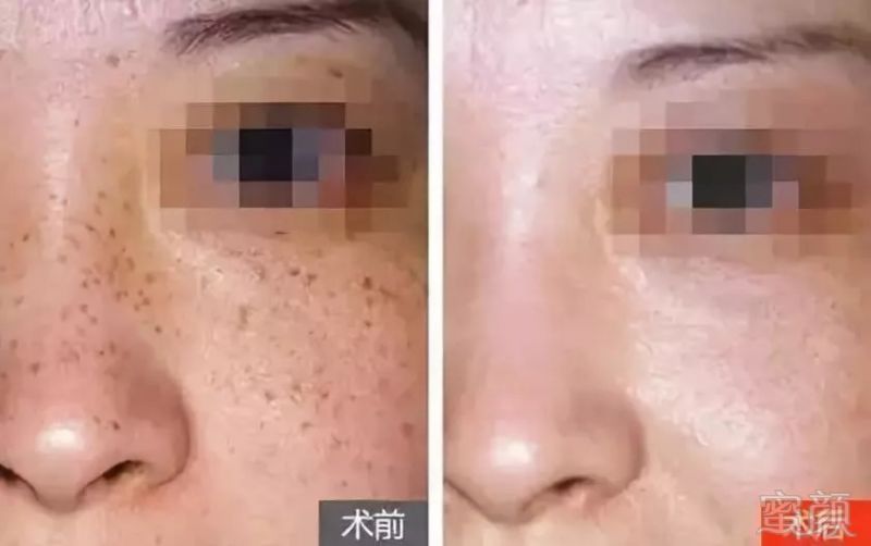 https://img.miyanlife.com/mnt/timg/180912/1251351507-7.jpg