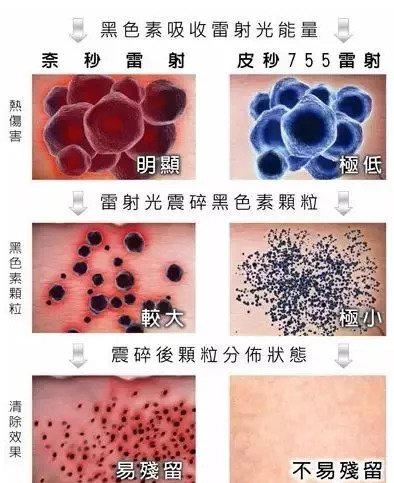 https://img.miyanlife.com/mnt/timg/180912/1251352Y3-10.jpg