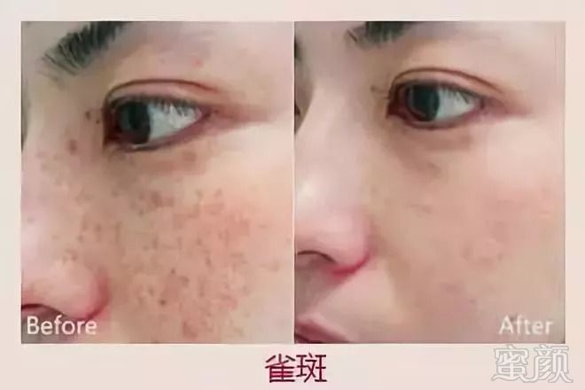 https://img.miyanlife.com/mnt/timg/180912/12513A563-12.jpg