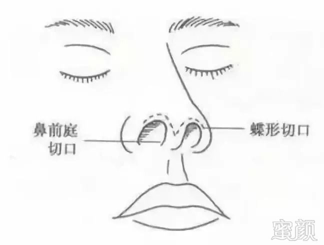 https://img.miyanlife.com/mnt/timg/180912/13012SA1-2.jpg