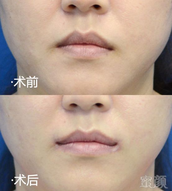 https://img.miyanlife.com/mnt/timg/180912/13020642G-11.jpg