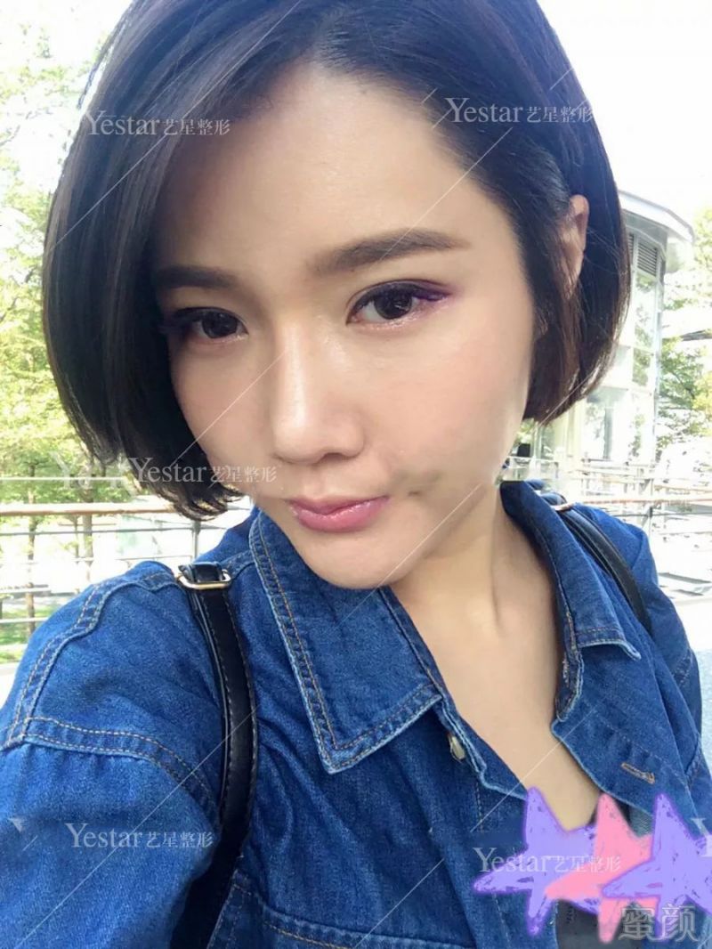 https://img.miyanlife.com/mnt/timg/180912/131R244C-10.jpg