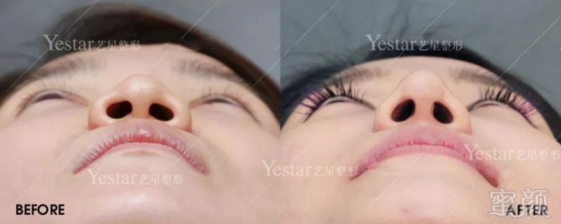 https://img.miyanlife.com/mnt/timg/180912/131R2H45-7.jpg