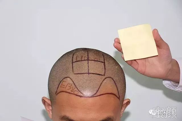 https://img.miyanlife.com/mnt/timg/180912/1331435625-2.jpg