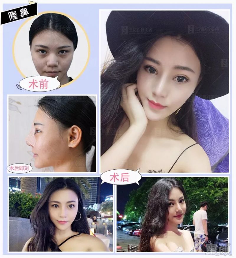 https://img.miyanlife.com/mnt/timg/180913/11003623G-3.jpg