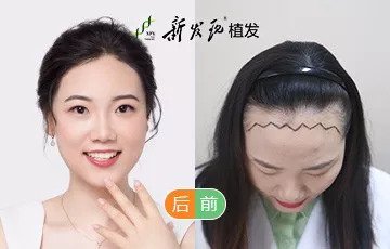 https://img.miyanlife.com/mnt/timg/180913/110A96052-11.jpg
