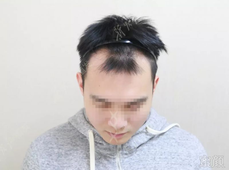 https://img.miyanlife.com/mnt/timg/180913/110AMH0-0.jpg