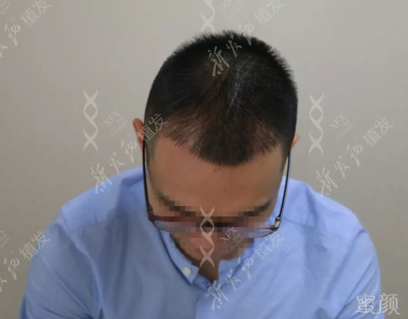 https://img.miyanlife.com/mnt/timg/180913/110AUI5-5.jpg