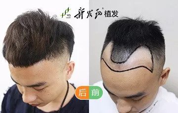 https://img.miyanlife.com/mnt/timg/180913/110Aa254-12.jpg