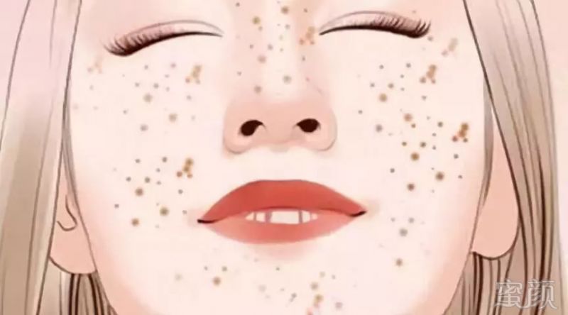https://img.miyanlife.com/mnt/timg/180913/11192R3K-0.jpg