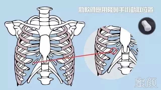 https://img.miyanlife.com/mnt/timg/180913/1119591038-8.jpg