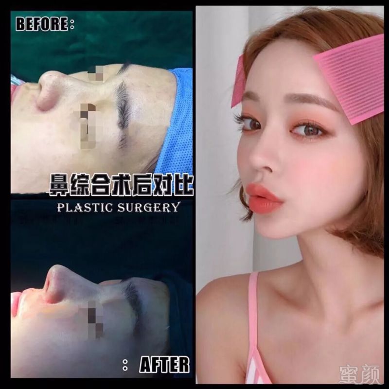 https://img.miyanlife.com/mnt/timg/180913/1119591044-7.jpg