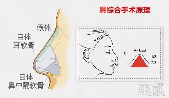 https://img.miyanlife.com/mnt/timg/180913/11195IH5-0.jpg