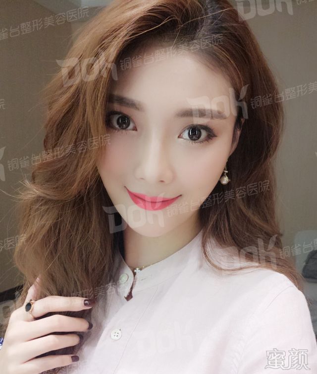 https://img.miyanlife.com/mnt/timg/180913/1121301035-0.jpg