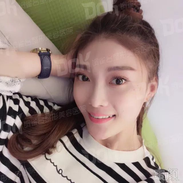 https://img.miyanlife.com/mnt/timg/180913/1121315305-6.jpg