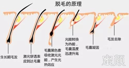 https://img.miyanlife.com/mnt/timg/180913/11363K232-12.jpg