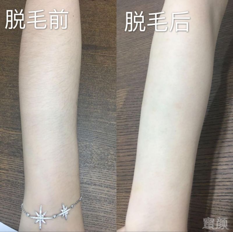 https://img.miyanlife.com/mnt/timg/180913/11363M328-13.jpg