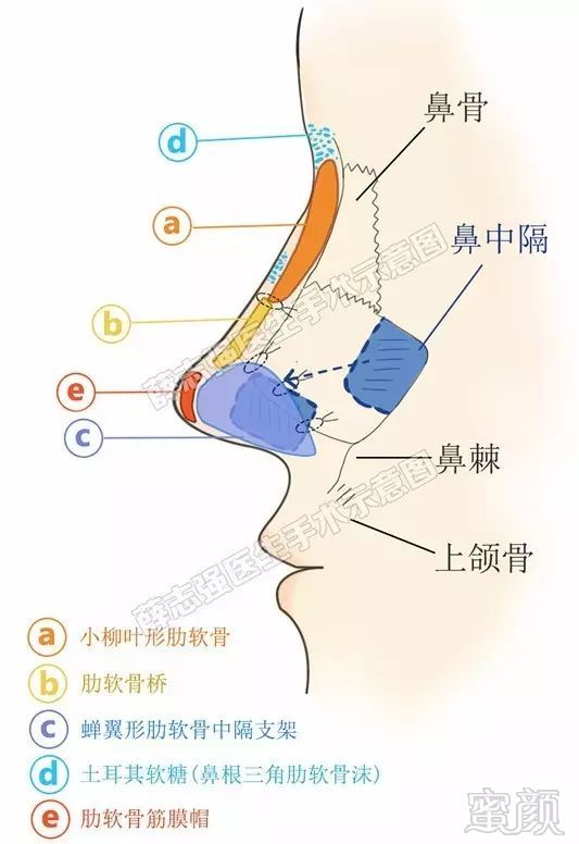 案例图片