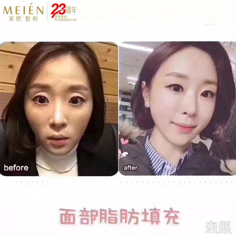 https://img.miyanlife.com/mnt/timg/180913/115G414D-5.jpg