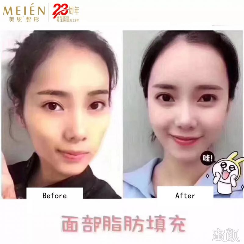 https://img.miyanlife.com/mnt/timg/180913/115G4KK-4.jpg
