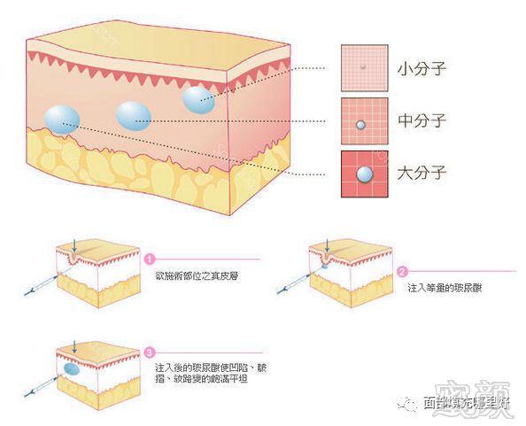 https://img.miyanlife.com/mnt/timg/180913/120442FU-0.jpg