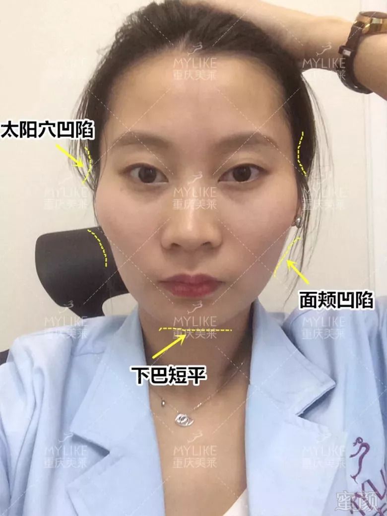https://img.miyanlife.com/mnt/timg/180913/12052L335-2.jpg