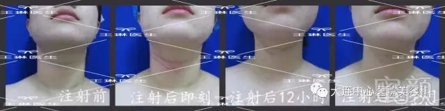 https://img.miyanlife.com/mnt/timg/180913/1206261402-7.jpg