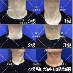 https://img.miyanlife.com/mnt/timg/180913/1206261J4-3.jpg