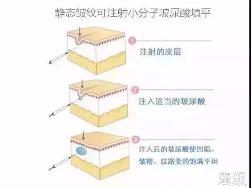 案例图片