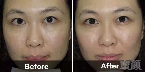 https://img.miyanlife.com/mnt/timg/180913/1255313P3-9.jpg