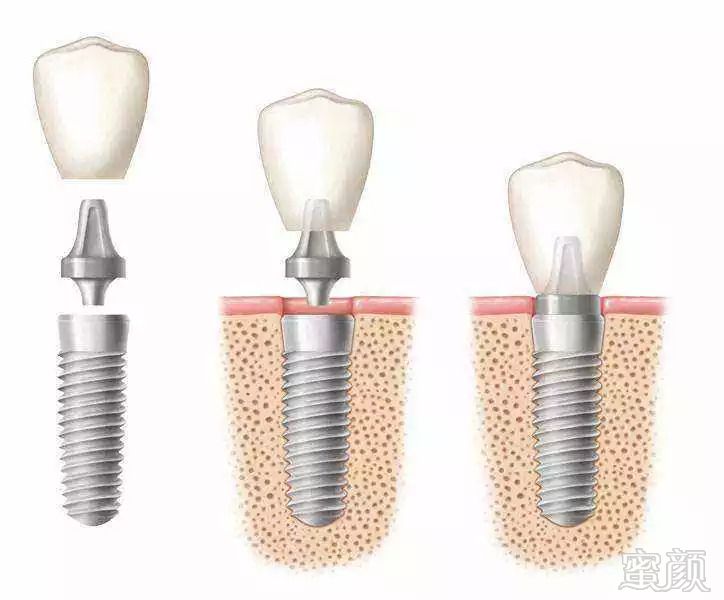 https://img.miyanlife.com/mnt/timg/180913/125G92T9-0.jpg