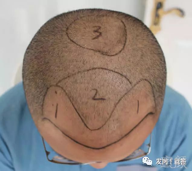 https://img.miyanlife.com/mnt/timg/180913/1301124a2-1.jpg
