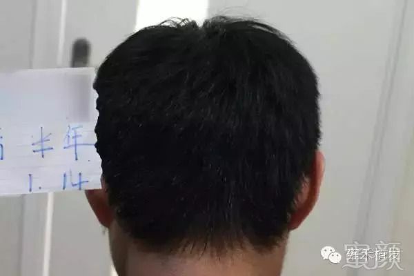 https://img.miyanlife.com/mnt/timg/180913/1303062013-10.jpg