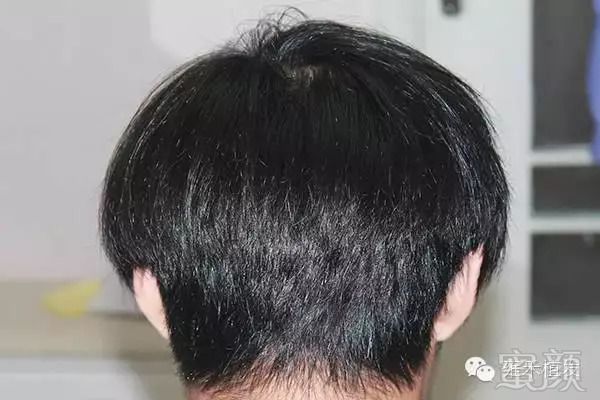 https://img.miyanlife.com/mnt/timg/180913/1303063T9-3.jpg