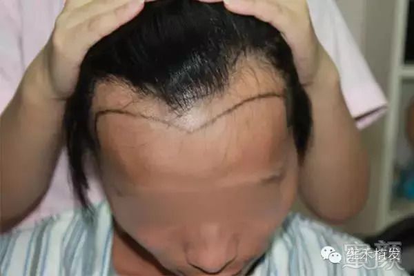 https://img.miyanlife.com/mnt/timg/180913/13030C448-2.jpg