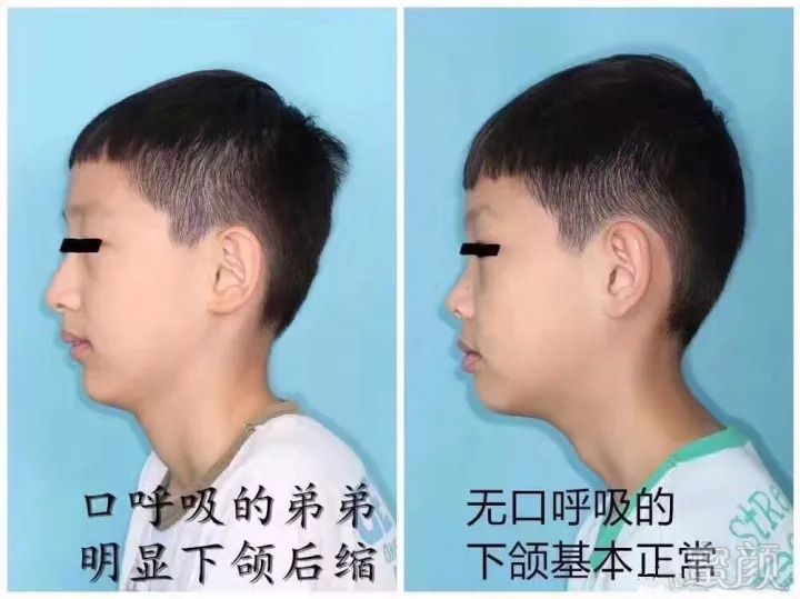 https://img.miyanlife.com/mnt/timg/180913/13115543L-5.jpg