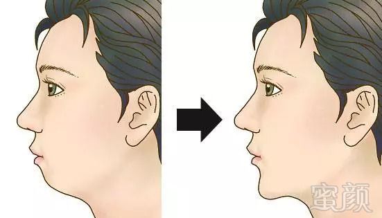 https://img.miyanlife.com/mnt/timg/180913/1311555932-14.jpg