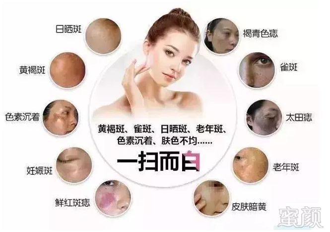 https://img.miyanlife.com/mnt/timg/180913/1315352256-2.jpg